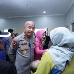 Polda Banten Berikan Layanan Operasi Bibir Sumbing Gratis